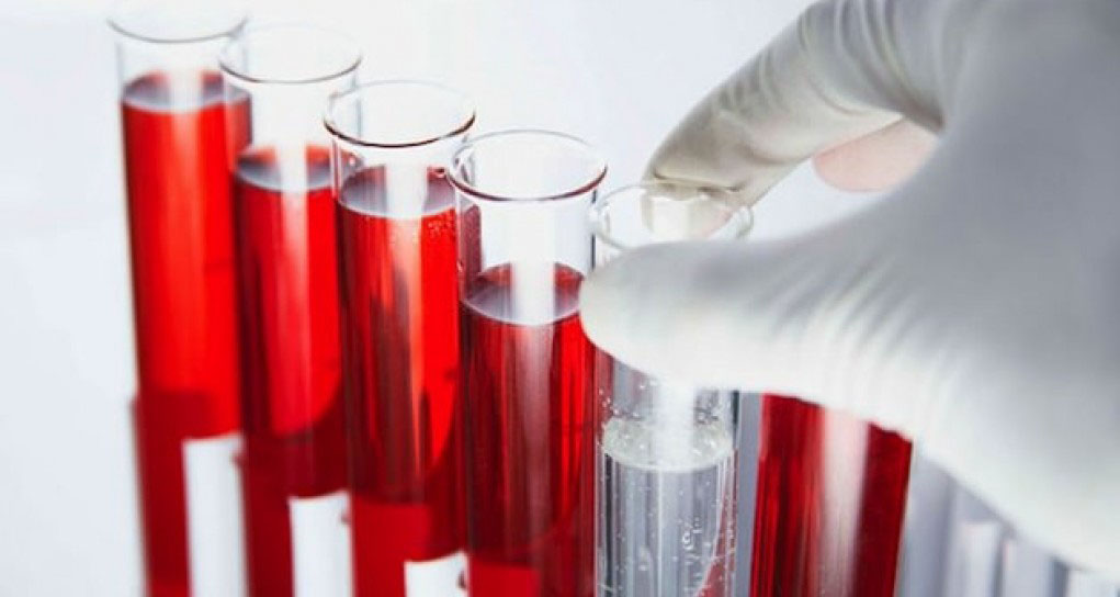 Метод анализа крови без укола разработан в БГУ