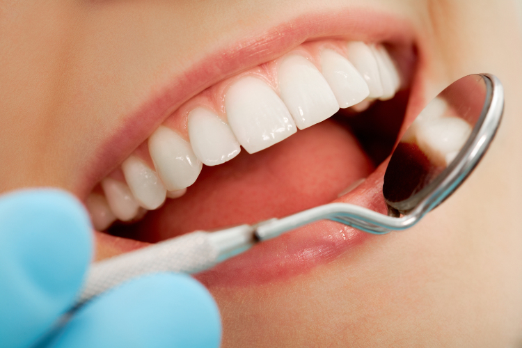 Новые зубные пломбы позволят реже ходить к стоматологу
