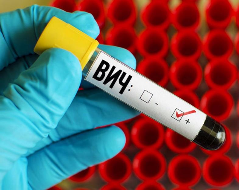 67 новых случаев ВИЧ выявлено в Могилевской области с начала года