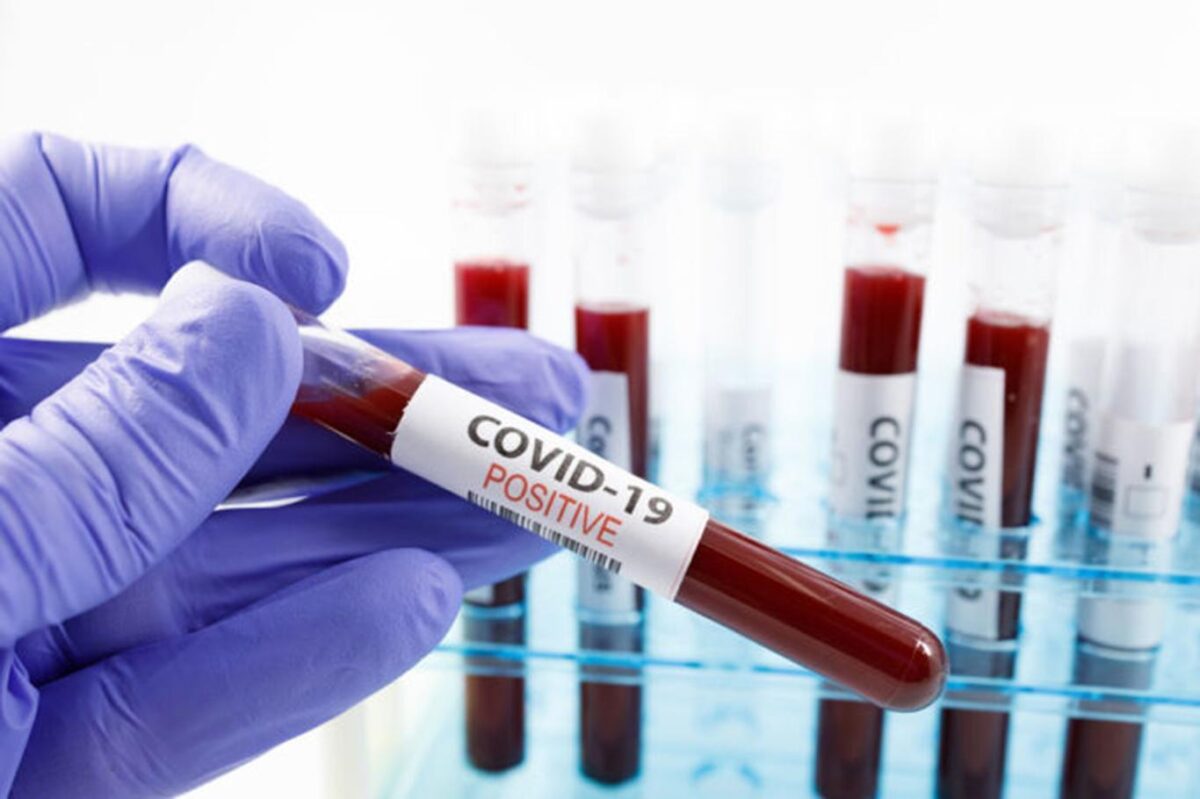 За неделю в мире зафиксированы 3,5 млн новых случаев заражения COVID-19