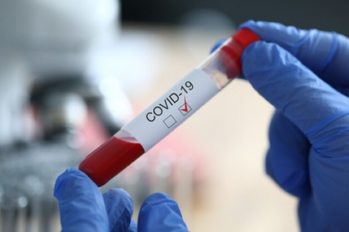 Более 541 тысячи случаев заражения коронавирусом выявили в мире за сутки