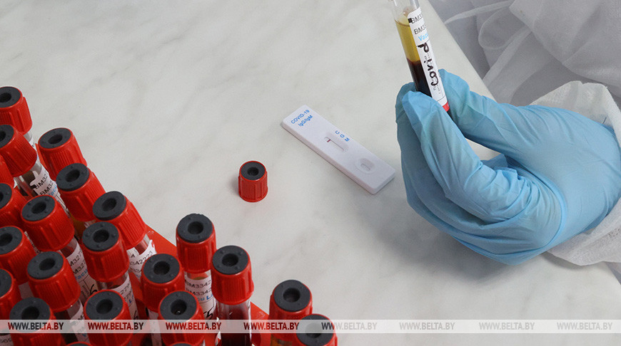 Белорусские ученые разработают комбинированный экспресс-тест для определения коронавируса и гриппа