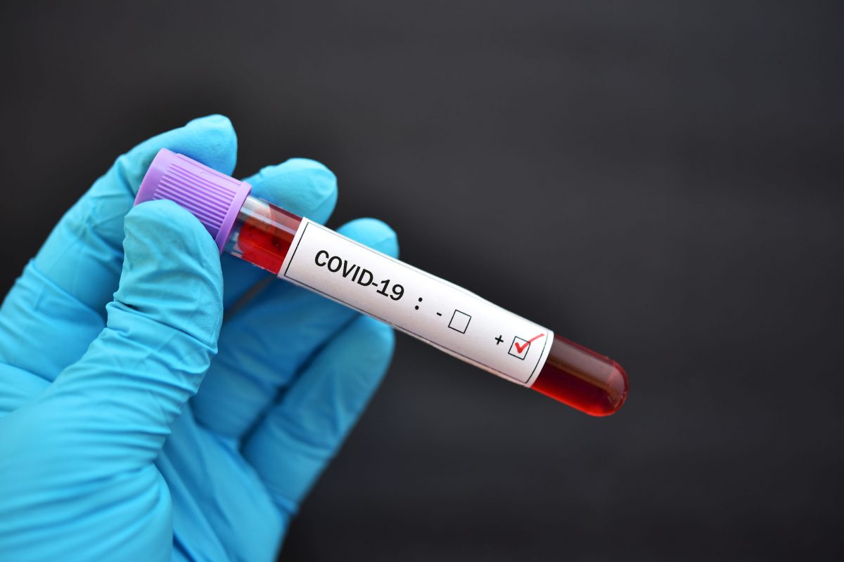 Вспышка COVID-19 в КНДР: заразились уже более 18 тыс. человек