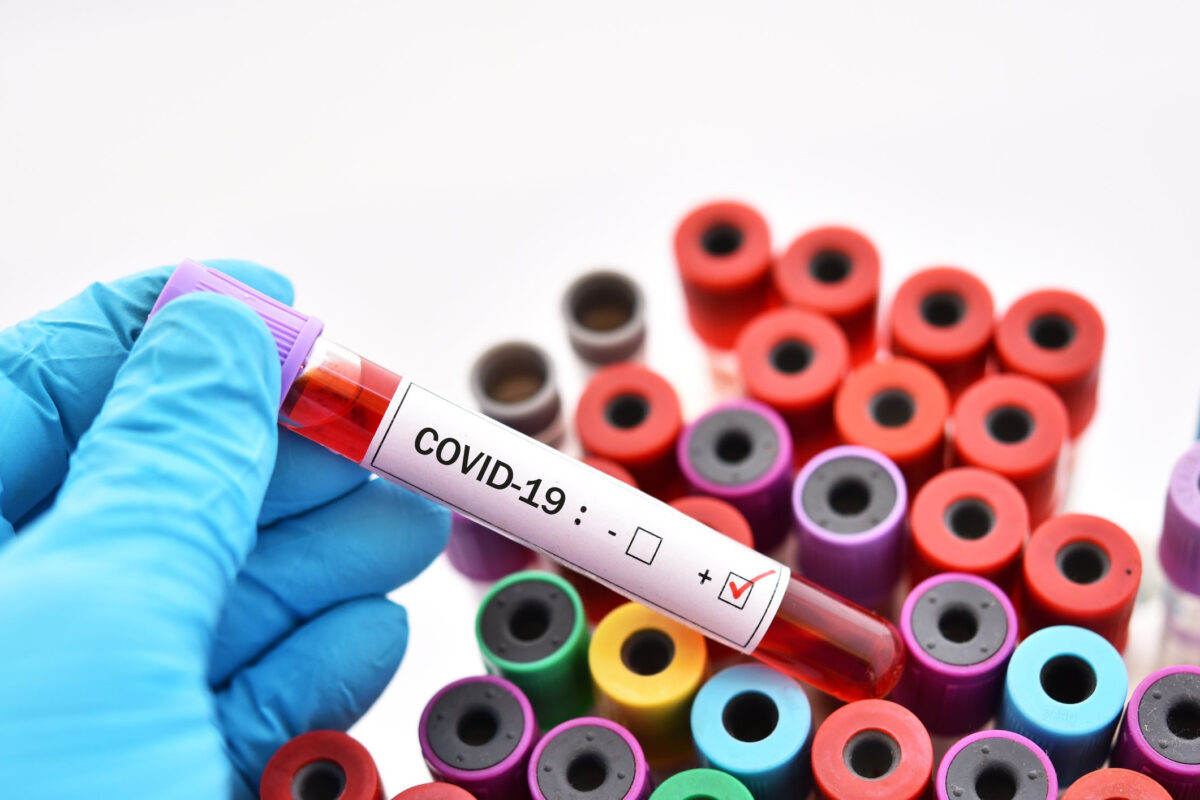 В США считают, что пандемия коронавируса могла произойти из-за инцидента с исследованием