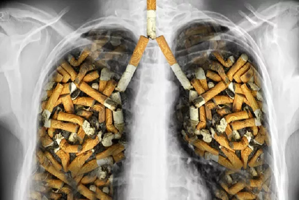 Почти 40% бобруйчан-мужчин курят. Что еще знают в зональном центре гигиены и эпидемиологии