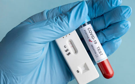 США с 5 января вводят обязательный тест на коронавирус для прибывших из КНР