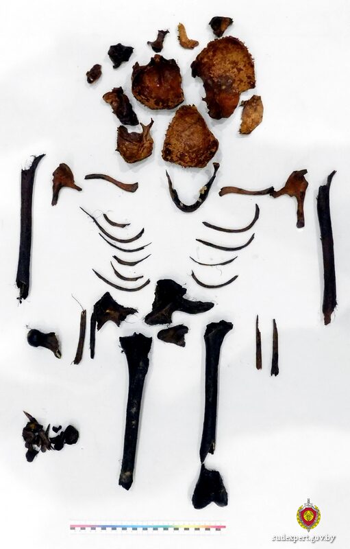 Человеческие останки времен Великой Отечественной войны исследовали судебные эксперты в Могилеве