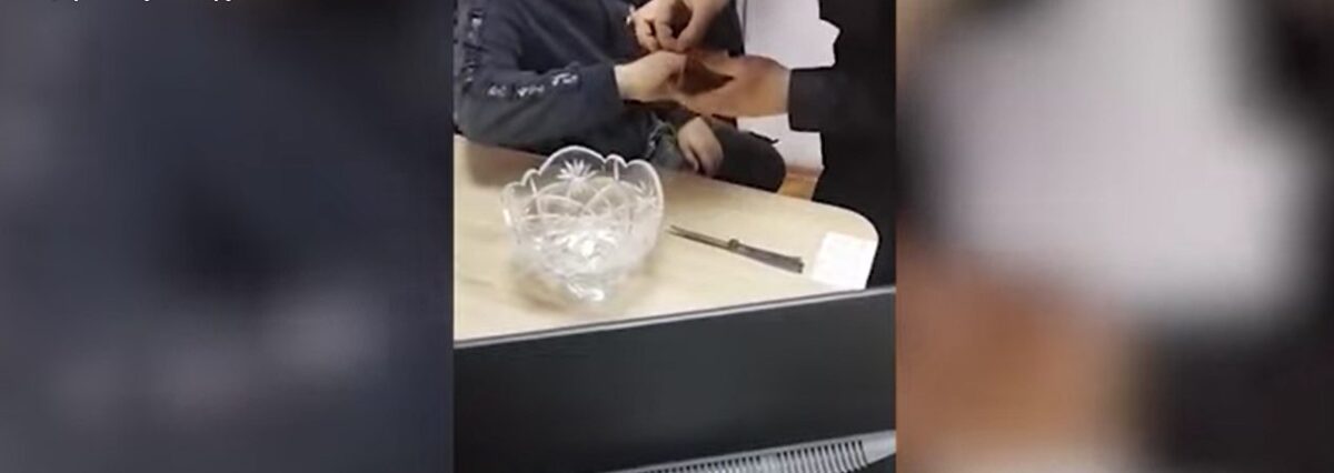 Спасатели помогли снять гардеробный номерок с пальца мальчика в Бобруйске